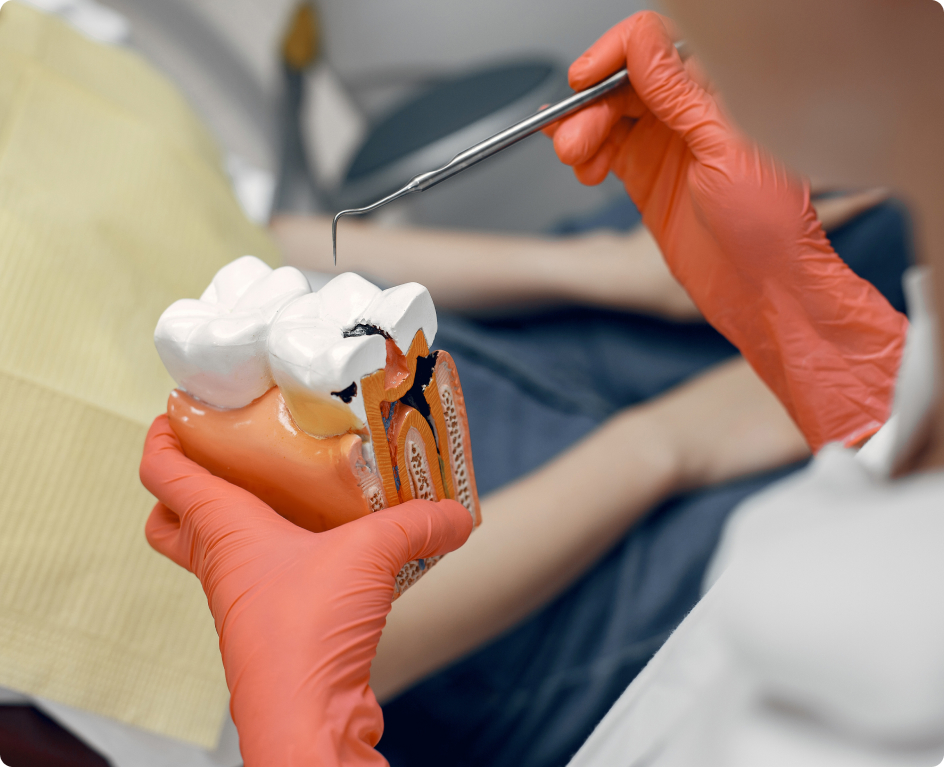 Cabinet dentaire A Murza réalise des traitements endodontique