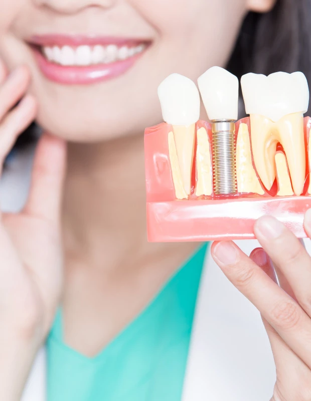 Implants dentaires, Dentistes Bastia