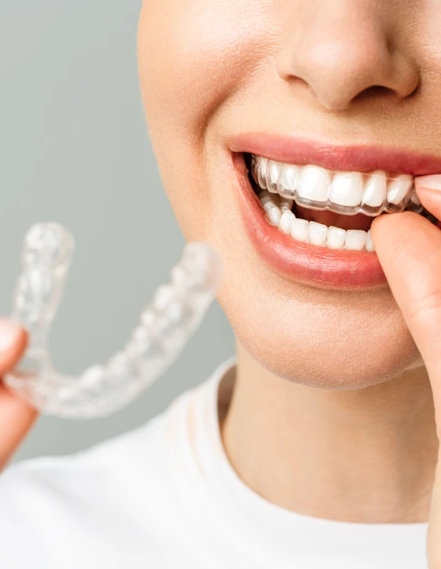 Dentistes Bastia, Orthodontie invisible à Furiani